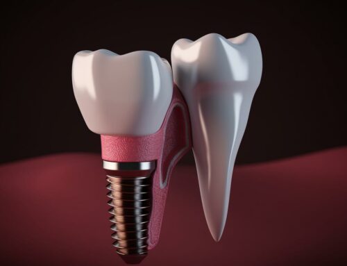 Имплантация зубов: безопасный и эффективный способ восстановления улыбки