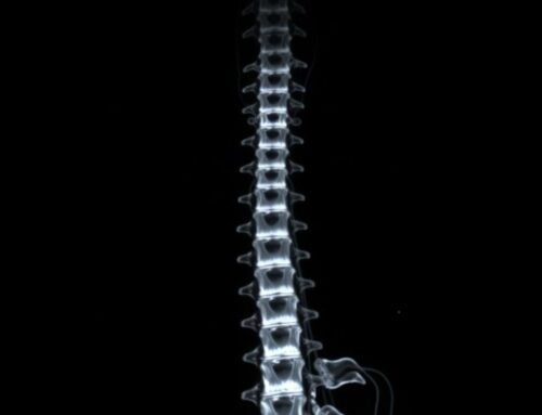 МРТ отделов позвоночника: что увидеть, как подготовиться и не потеряться в заключении