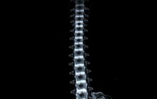 МРТ отделов позвоночника: что увидеть, как подготовиться и не потеряться в заключении